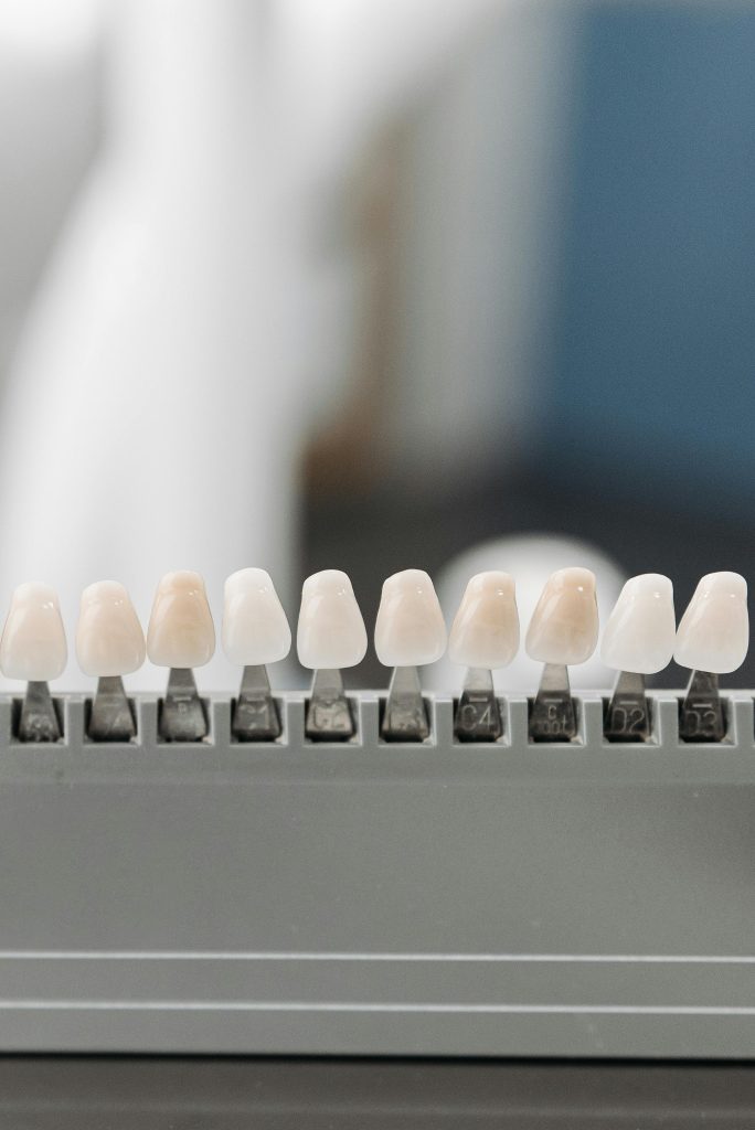 Close-up of flawlessly crafted porcelain veneers showing their natural translucency.